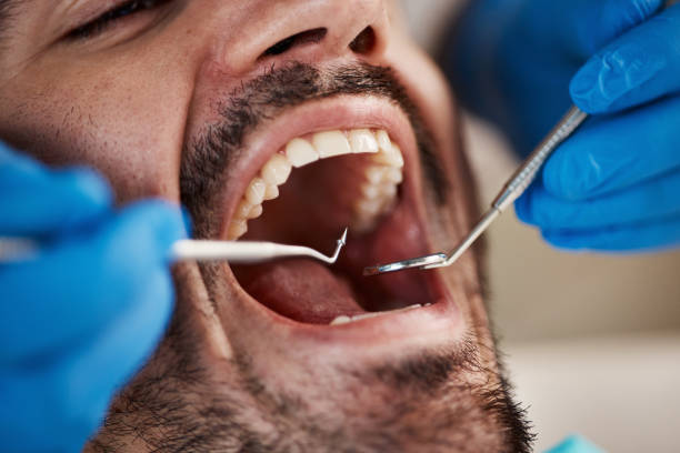 Best Broken Tooth Emergency  in Millsboro, DE